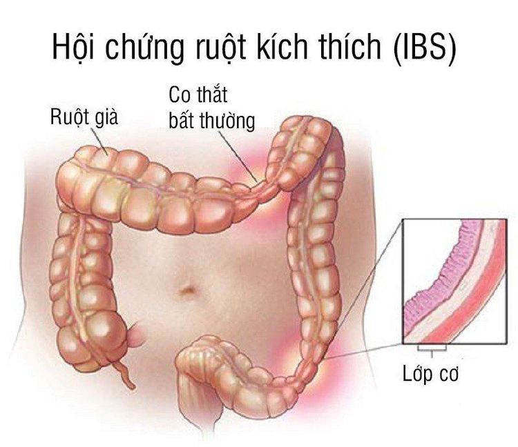 nguyên nhân đầy bụng - Image 3