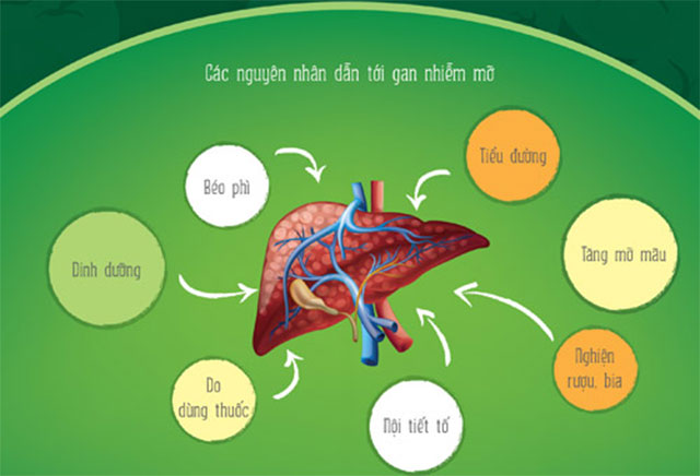 nguyên nhân gan nhiễm mỡ - Image 2