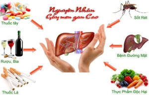 nguyên nhân gan nhiễm mỡ