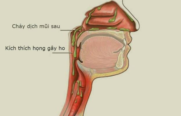nguyên nhân ho kéo dài - Image 2