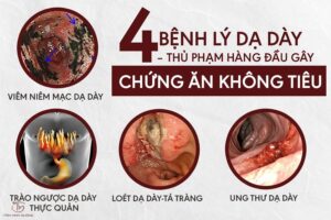 nguyên nhân khó tiêu