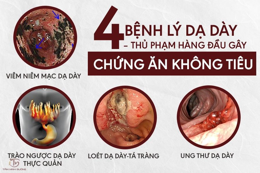 nguyên nhân khó tiêu