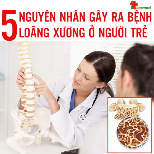 nguyên nhân loãng xương - Image 3