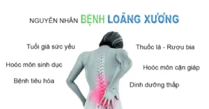 nguyên nhân loãng xương
