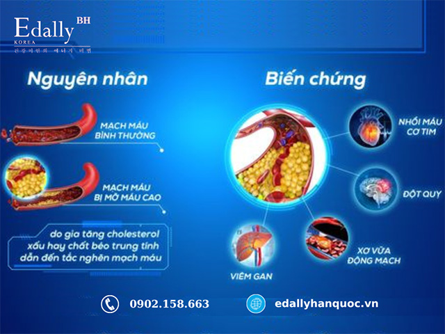 nguyên nhân mỡ máu cao - Image 3