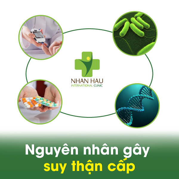 nguyên nhân suy thận cấp - Image 4