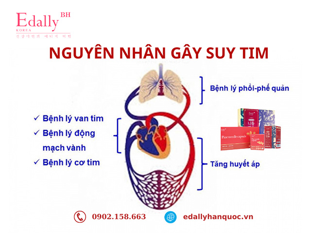 nguyên nhân suy tim - Image 3