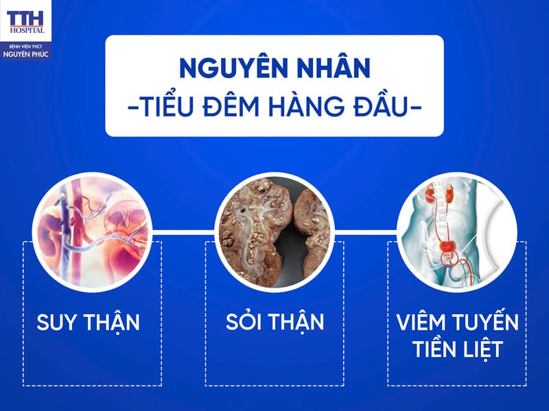 nguyên nhân tiểu nhiều - Image 3