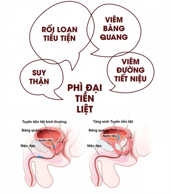 nguyên nhân tiểu nhiều - Image 4