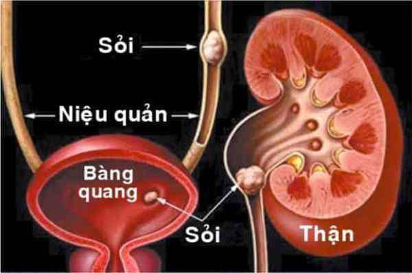 nguyên nhân tiểu nhiều - Image 1