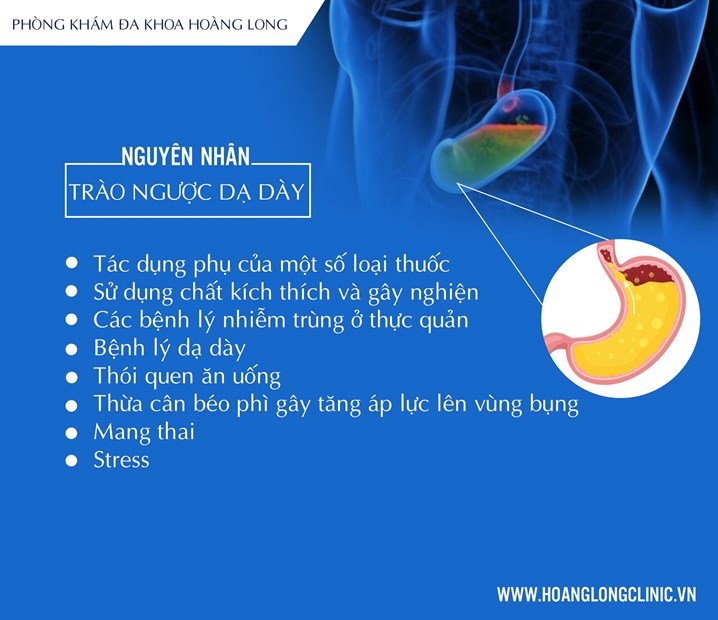 nguyên nhân trào ngược dạ dày - Image 4