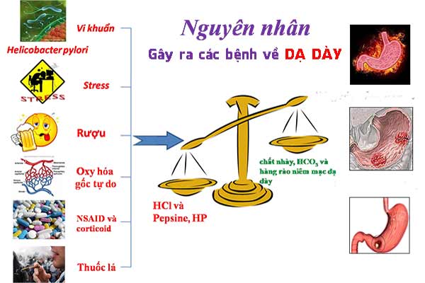 nguyên nhân viêm dạ dày