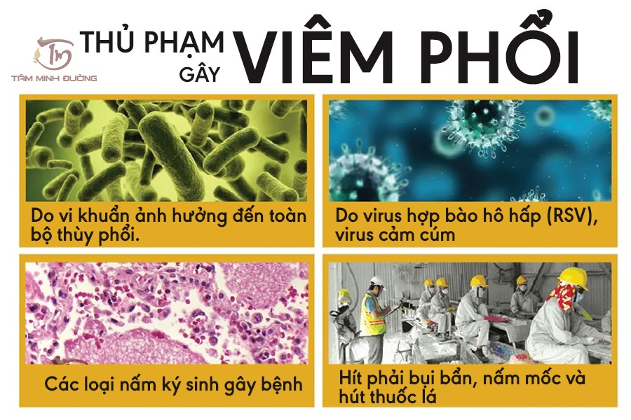 nguyên nhân viêm phổi - Image 2