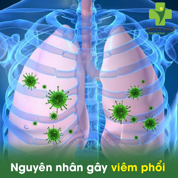 nguyên nhân viêm phổi - Image 4