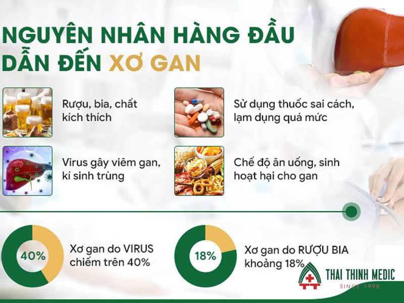 nguyên nhân xơ gan - Image 2