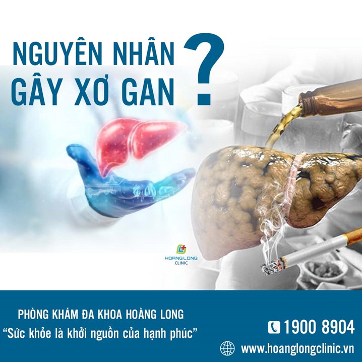 nguyên nhân xơ gan - Image 4