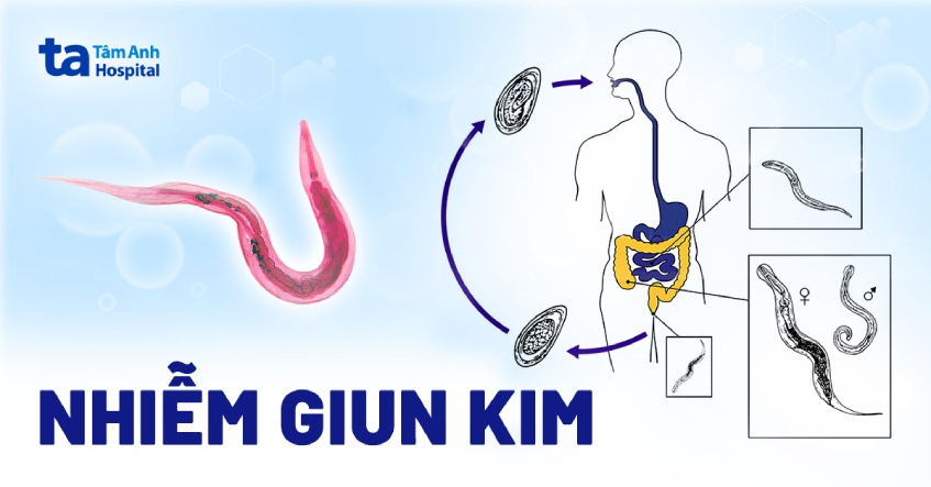 nhiễm giun kim - Image 4