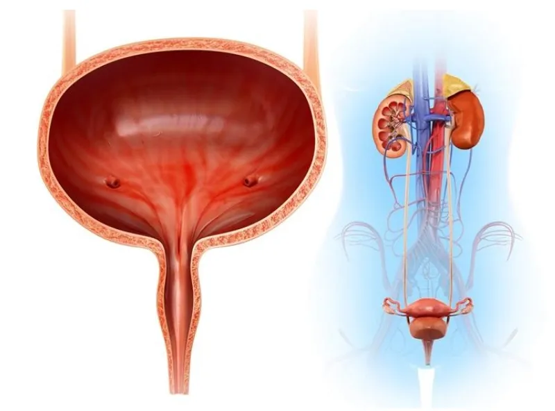 nhiễm trùng bàng quang - Image 4