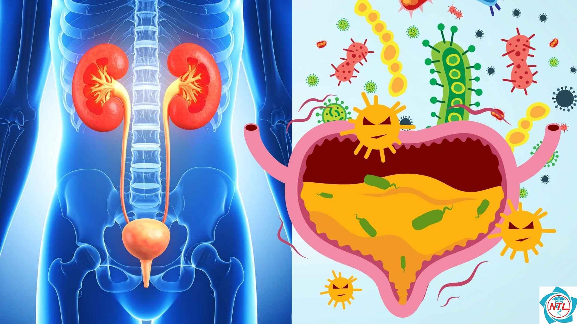 nhiễm trùng đường tiết niệu tái phát - Image 2