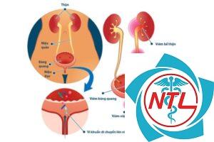 nhiễm trùng niệu đạo