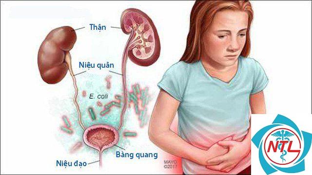 nhiễm trùng tiết niệu ở trẻ em - Image 2
