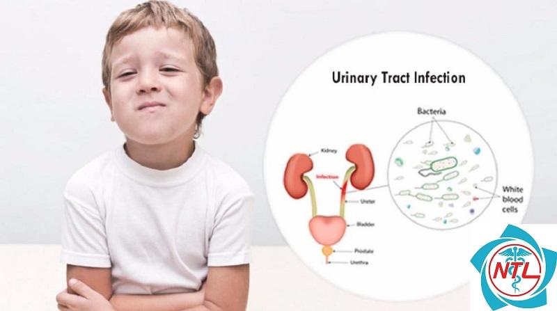 nhiễm trùng tiết niệu ở trẻ em - Image 3