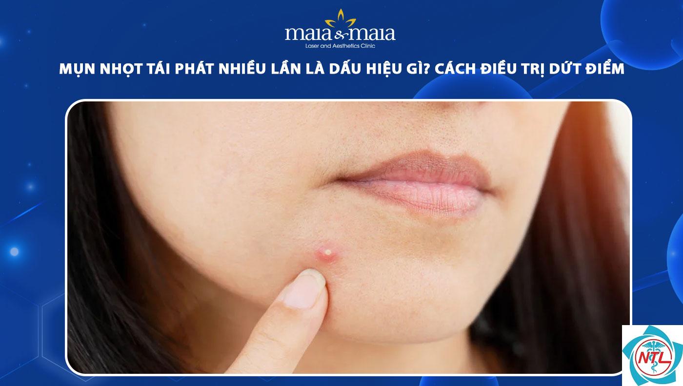 nhọt da tái phát - Image 5