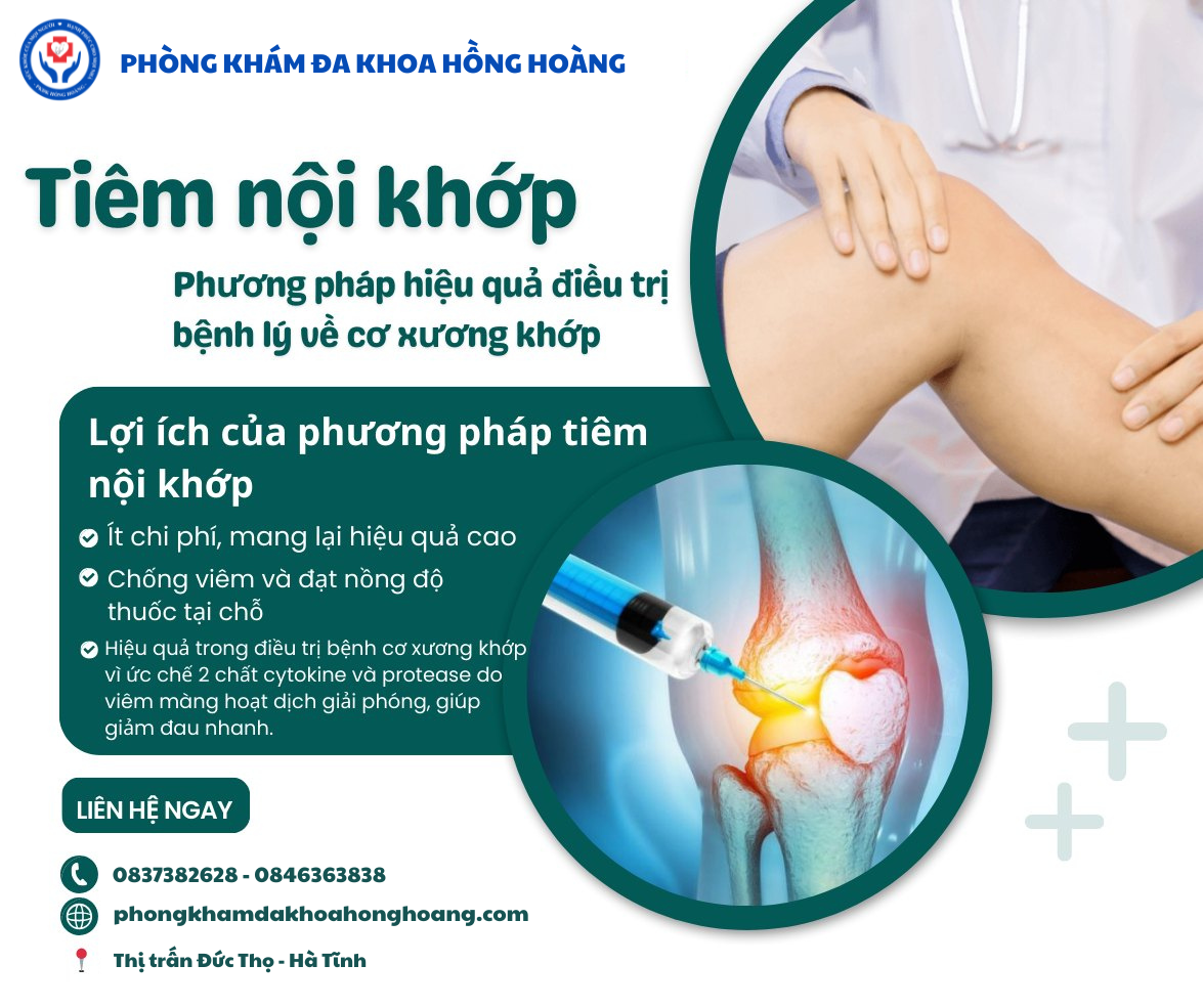 nội tổng hợp điều trị bệnh cơ xương khớp - Image 3