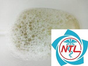 nước tiểu có bọt