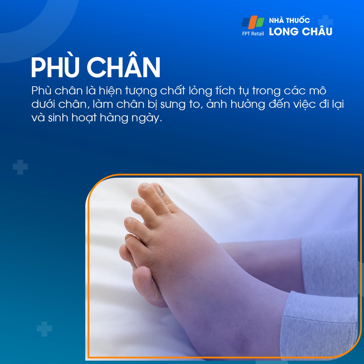 phù chân khám khoa nội tổng hợp - Image 1