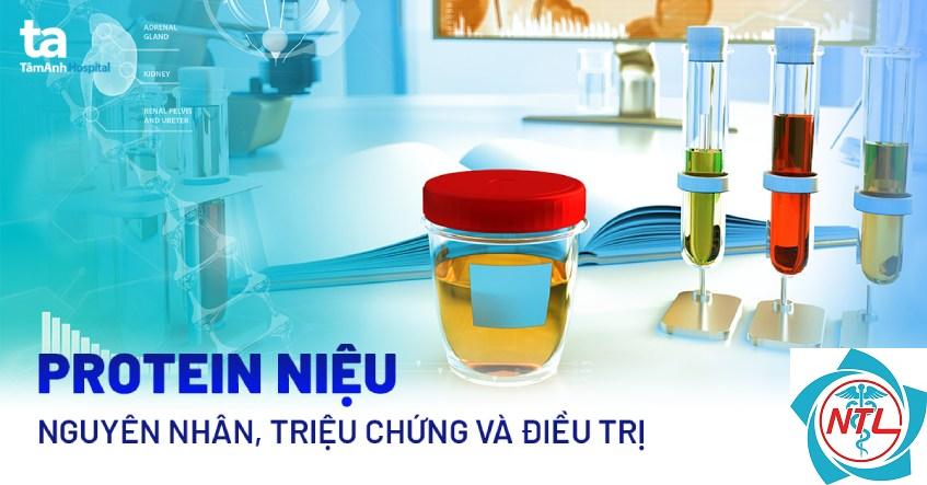 protein niệu - Image 3