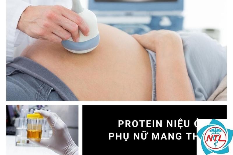 protein niệu khi mang thai - Image 3