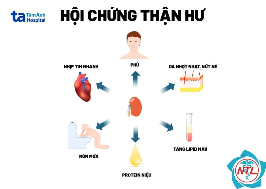 protein niệu ở trẻ em - Image 2
