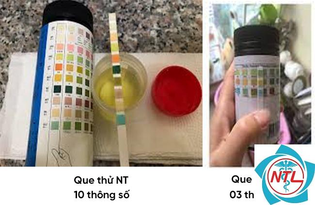 protein niệu ở trẻ em - Image 4