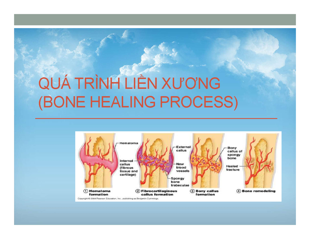 quá trình liền xương - Image 2