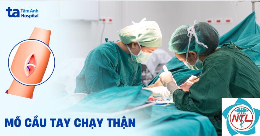 quy trình mổ cầu tay - Image 4