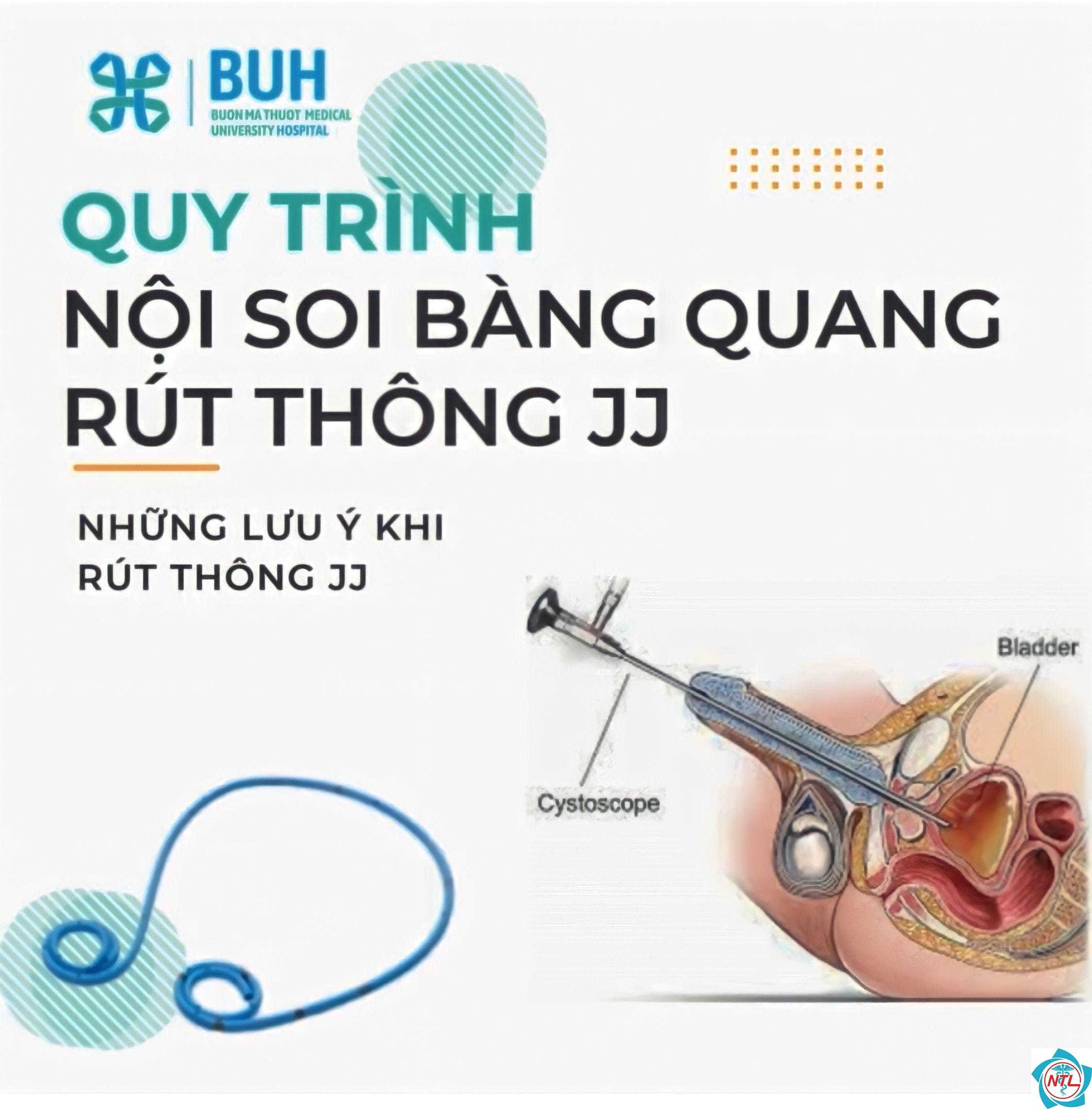 quy trình rút ống jj - Image 1