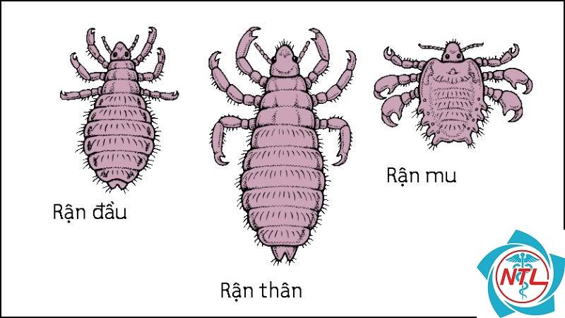 rận đầu