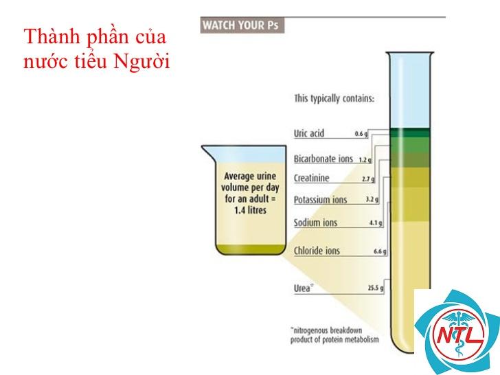 rối loạn bài xuất nước tiểu - Image 3