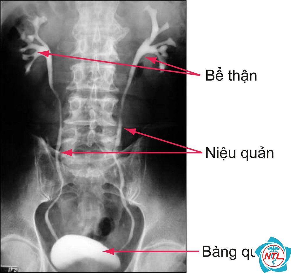 rối loạn chức năng bàng quang - Image 2
