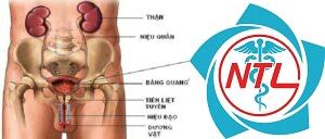 rối loạn chức năng bàng quang