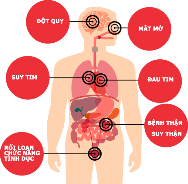 rối loạn huyết áp ở người cao tuổi - Image 4