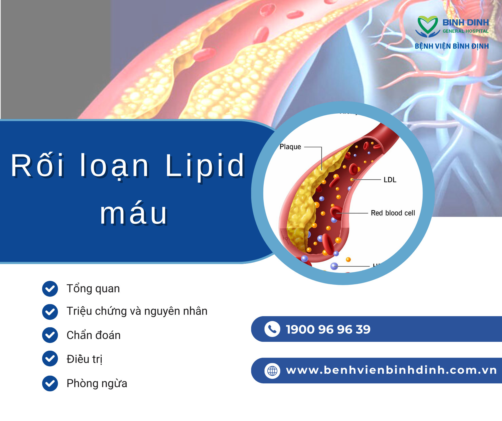 rối loạn lipid máu và bệnh tim - Image 4