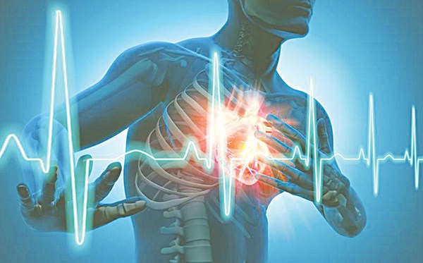 rối loạn nhịp tim và đột quỵ