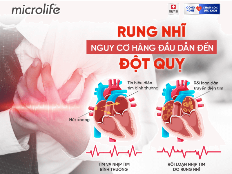 rung nhĩ ở người cao tuổi - Image 2