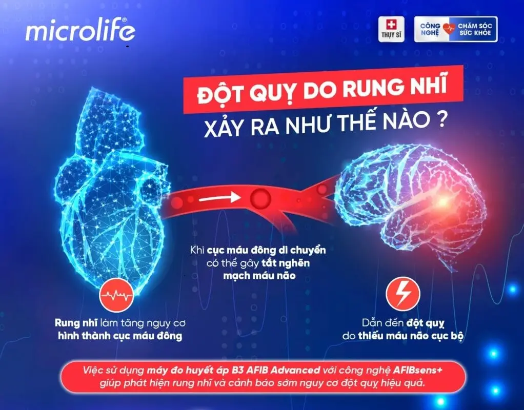 rung nhĩ ở người cao tuổi - Image 3