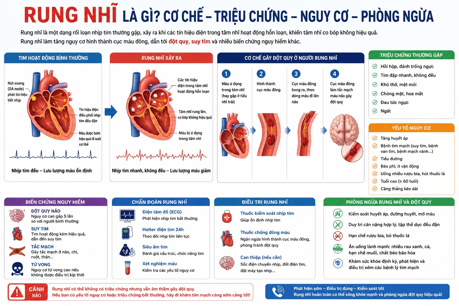 rung nhĩ và nguy cơ đột quỵ - Image 3