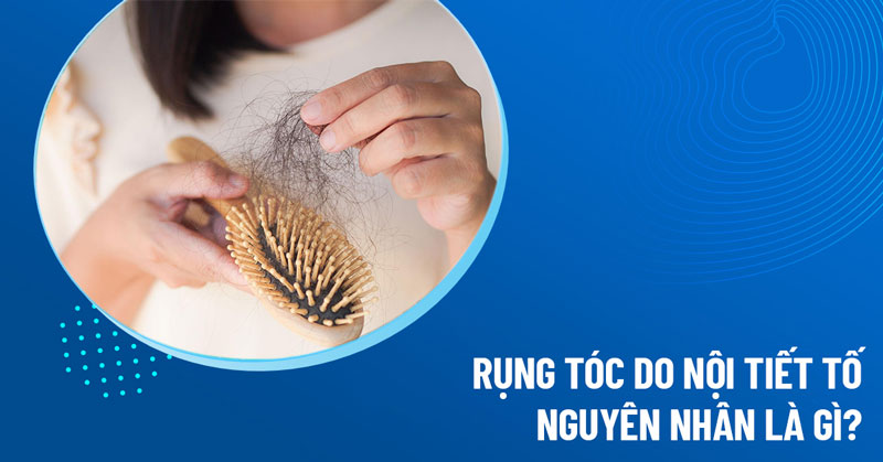 rụng tóc do nội tiết - Image 4