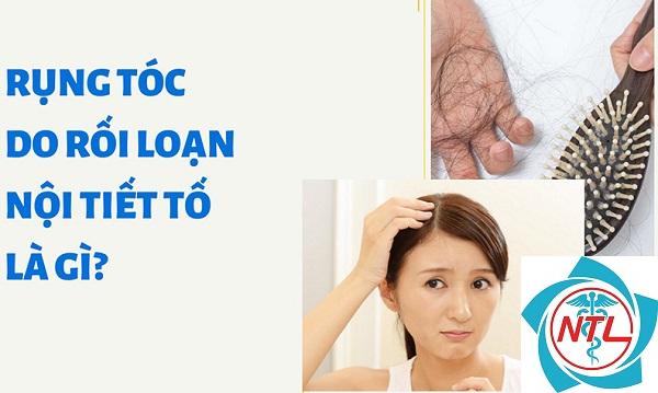 rụng tóc do nội tiết ở phụ nữ - Image 2