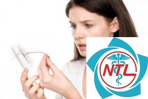 rụng tóc do nội tiết ở phụ nữ